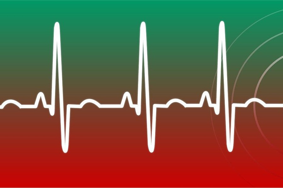 TRUMPET NOTES: December 15, 2021